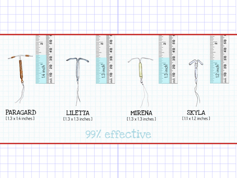 a graphic saying that the IUD is 99% effective